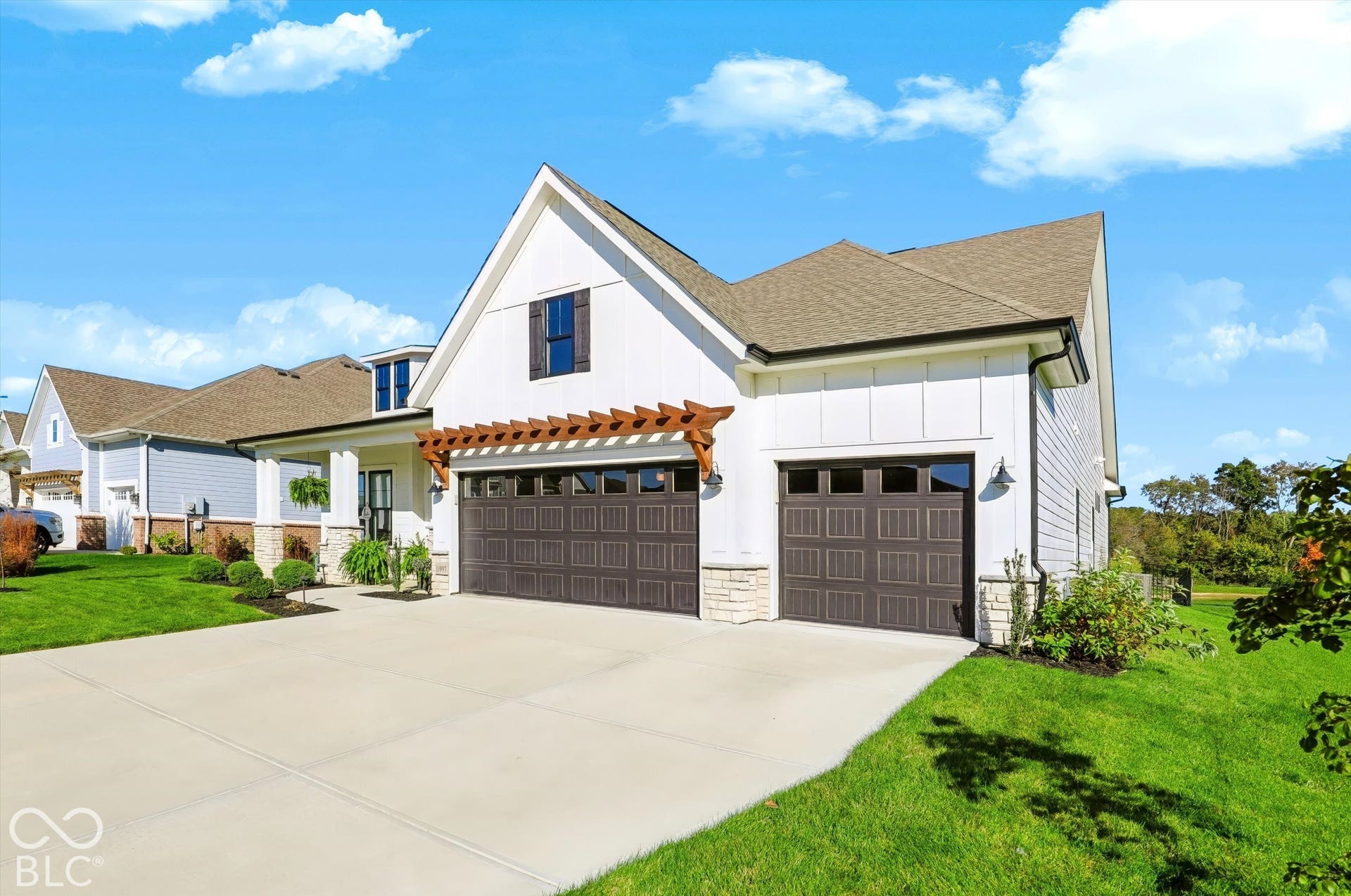Exterior featuring board-and-batten siding, stone masonry accents, a wood-beam pergola, a three-car garage with carriage-style doors, and an expansive concrete driveway