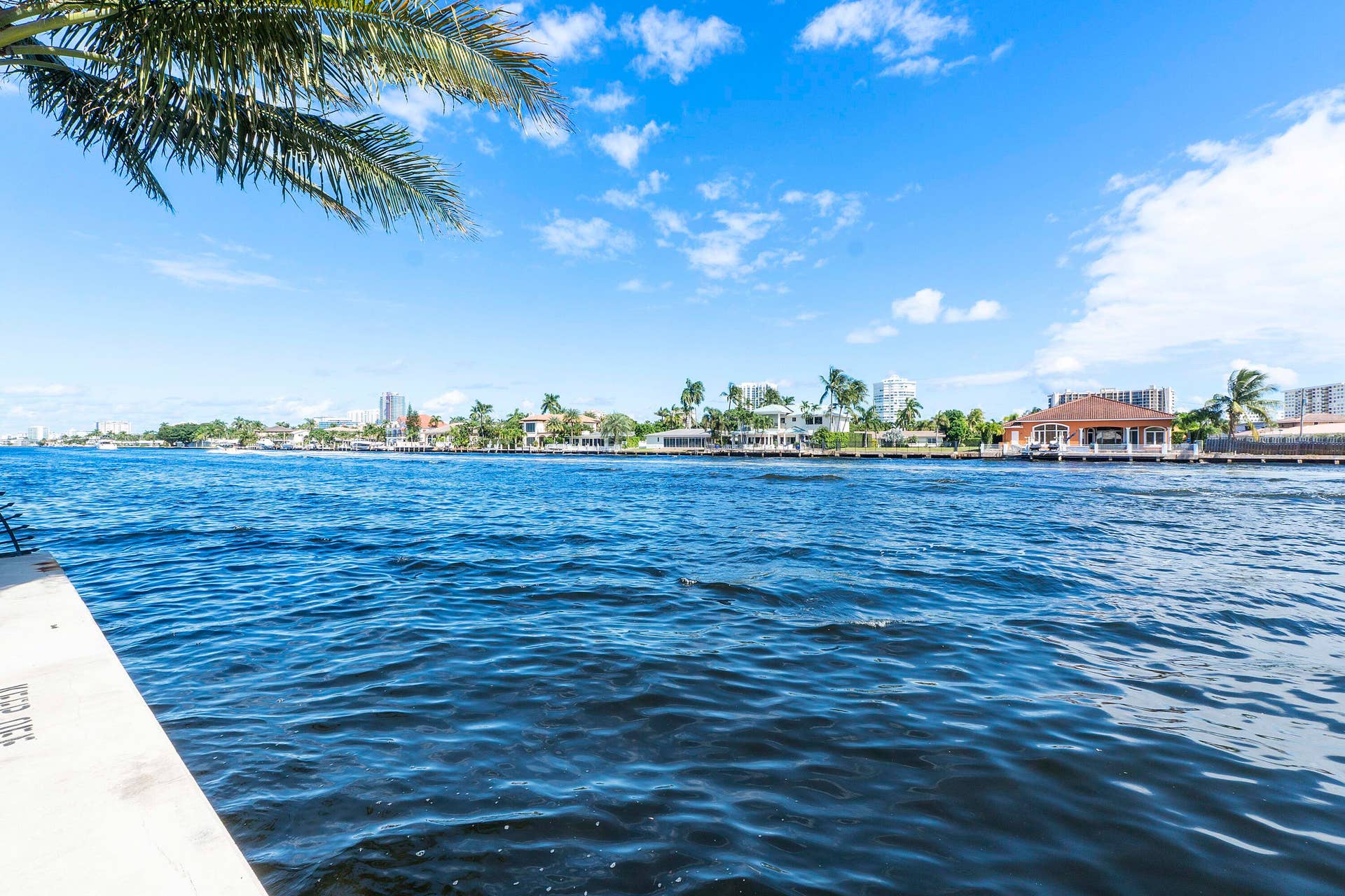 Intracostal